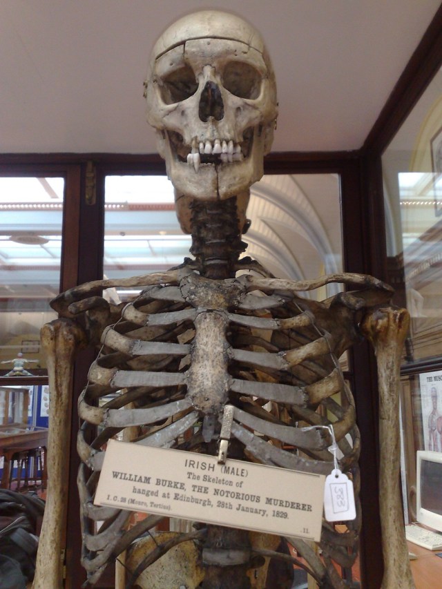 The skeleton of William Burke. On display at Edinburgh's Anatomy Museum. Image courtesy of Murderpedia 